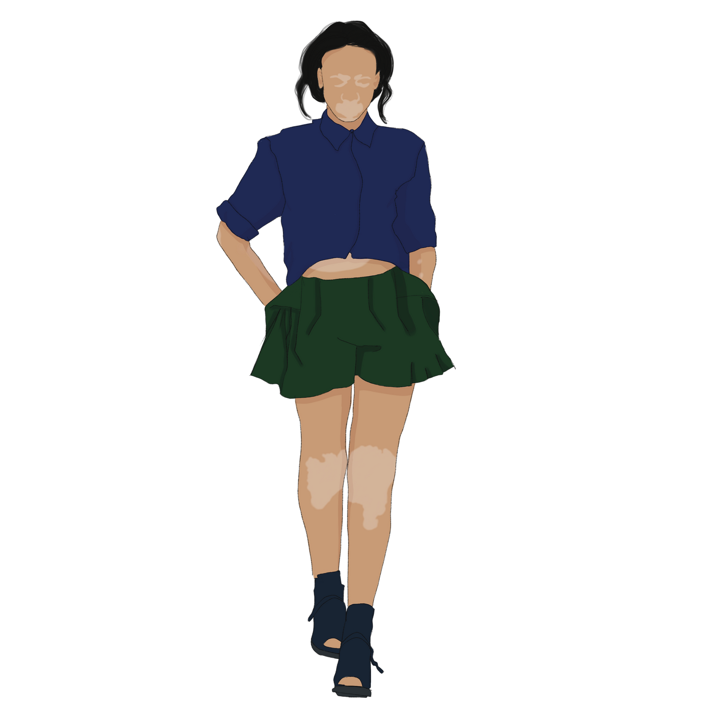 human walking with pigment disorder