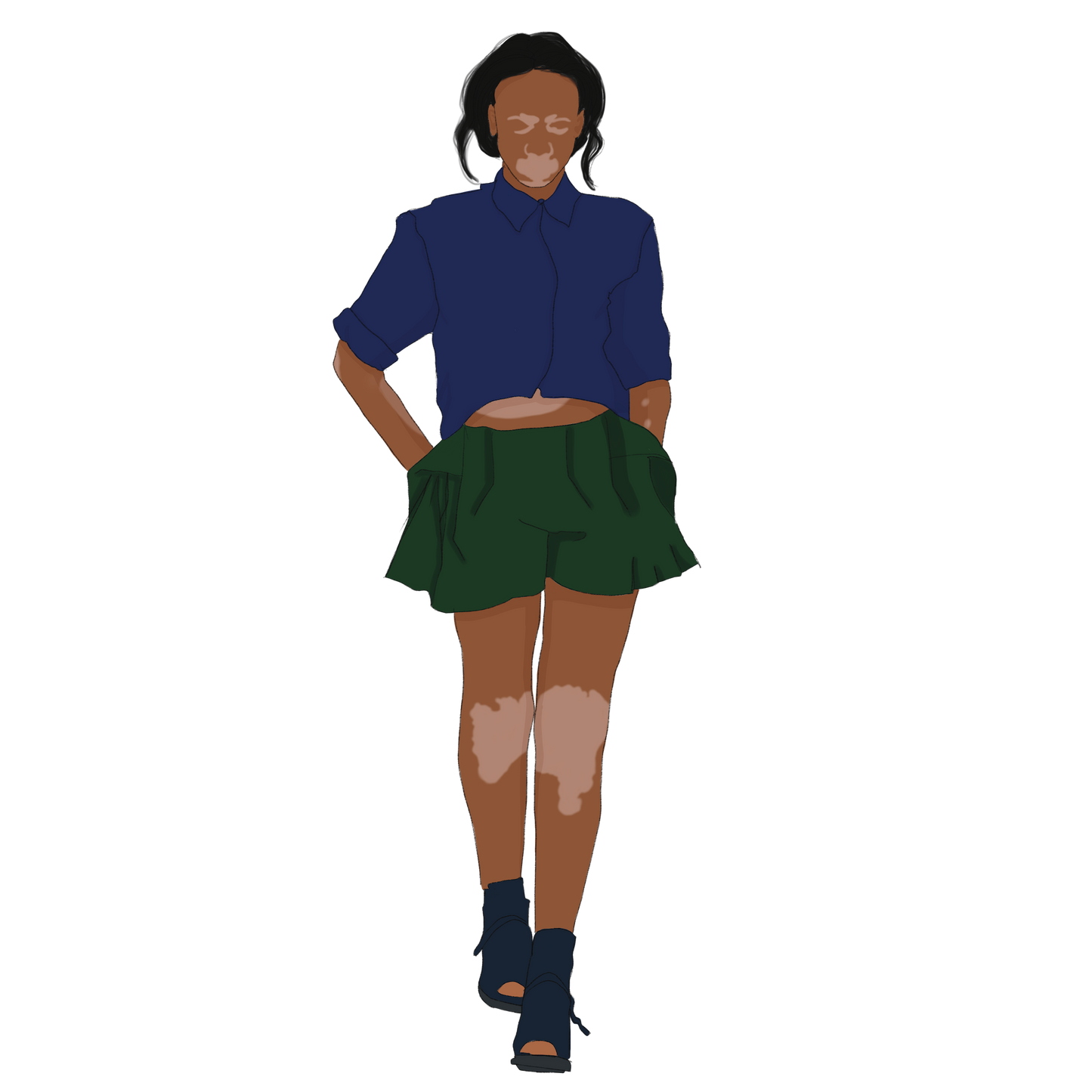 human with pigment disorder