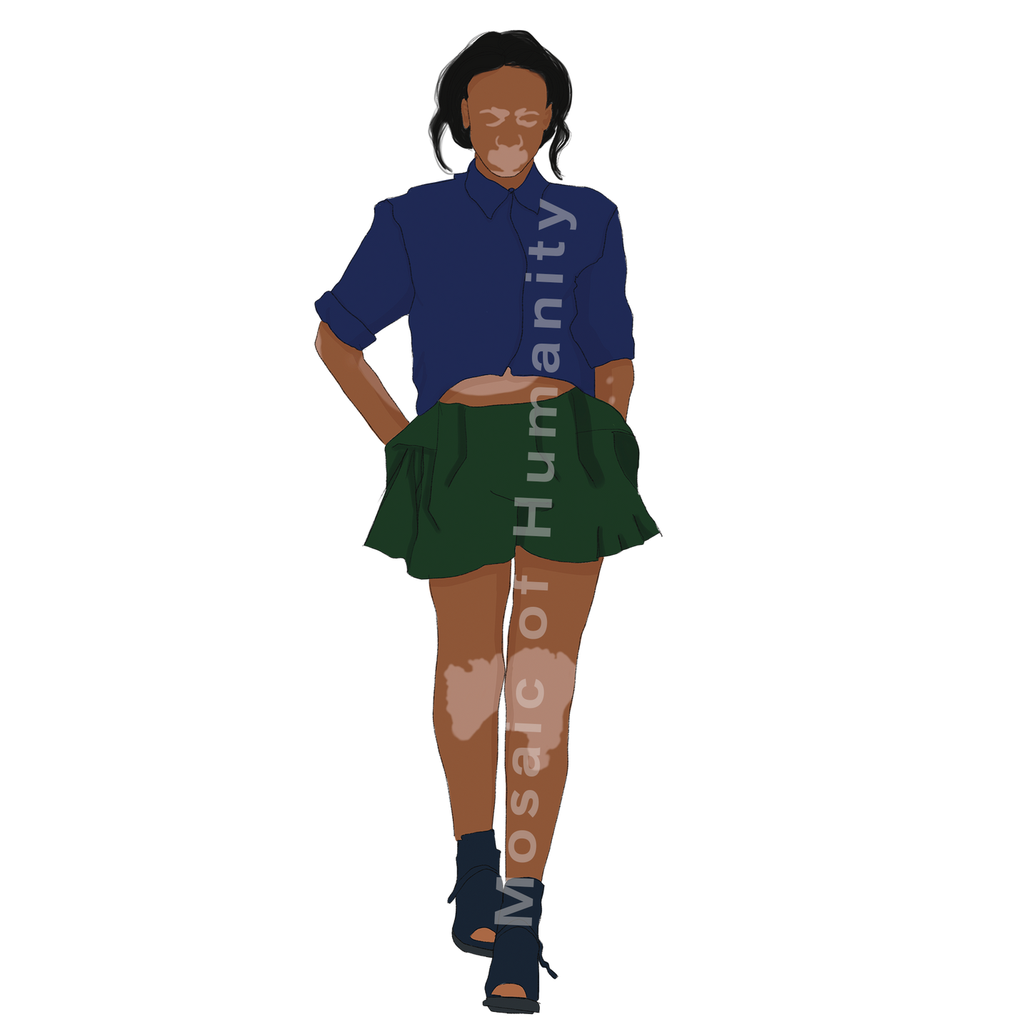 human with pigment disorder