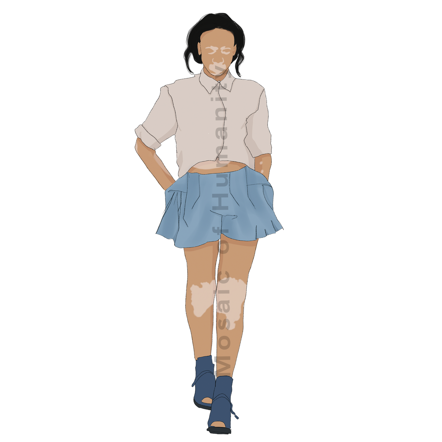 human walking with pigment disorder