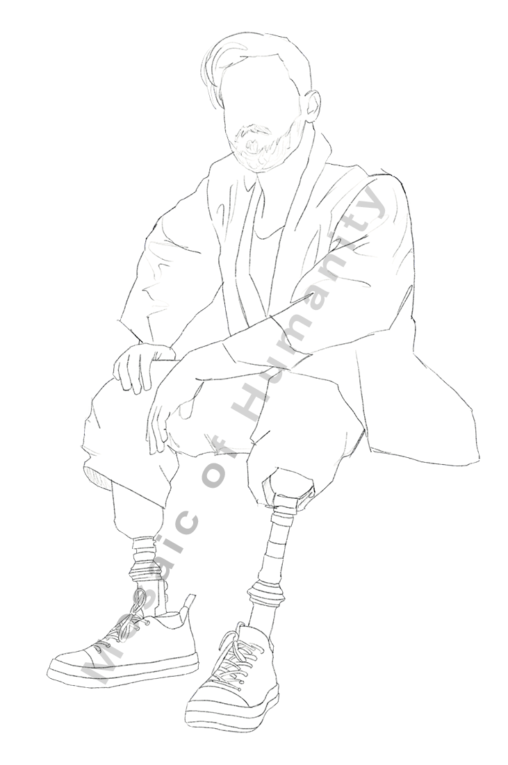 human with prosthesis